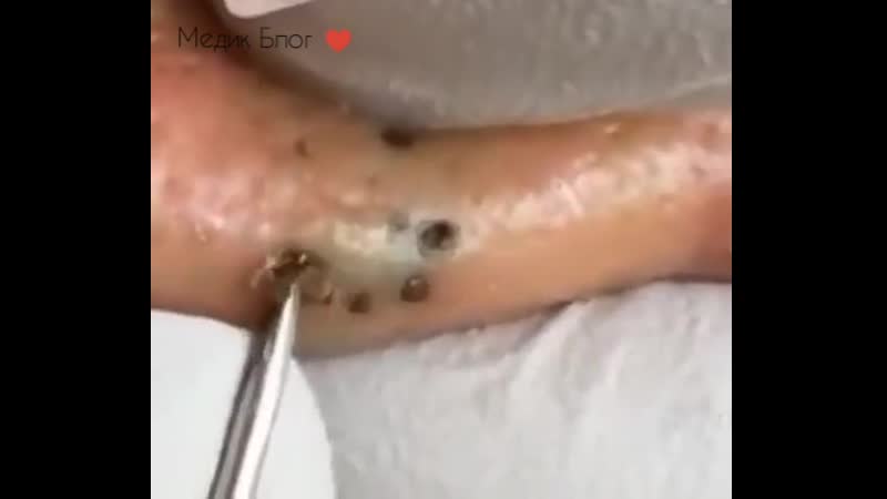 Срочно разыскивается рассадник черных точек