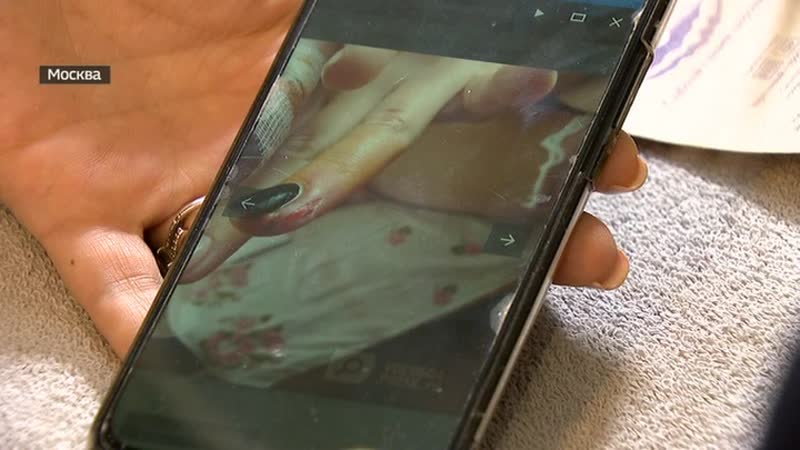 Вологодская школьница едва не осталась без пальцев после маникюра