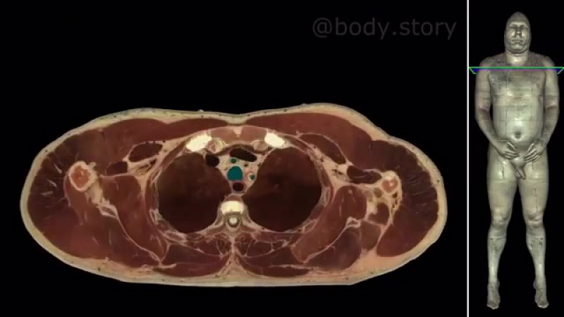 Магниторезонансная томография (мрт)
