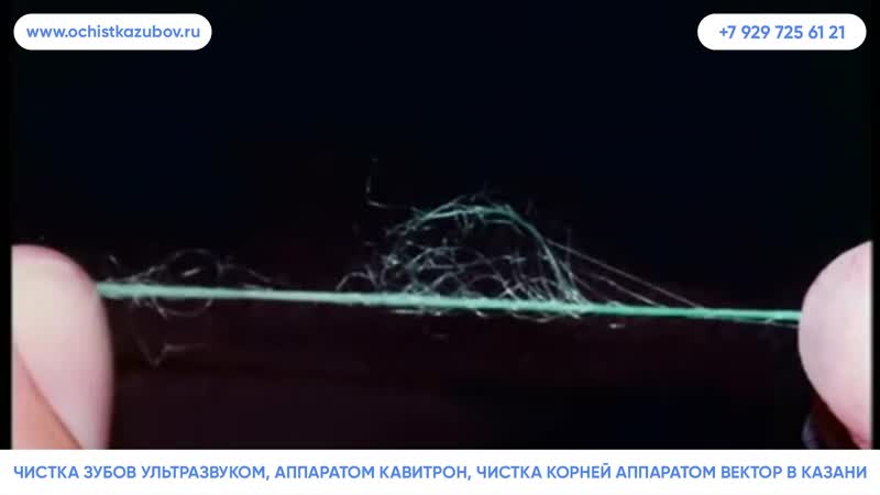 – ультразвуковая чистка зубов в казани