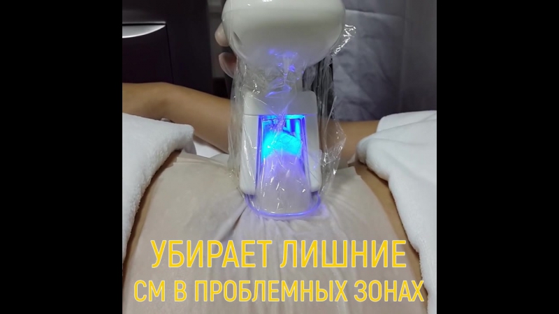 Коррекция фигуры с помощью криолиполиза!