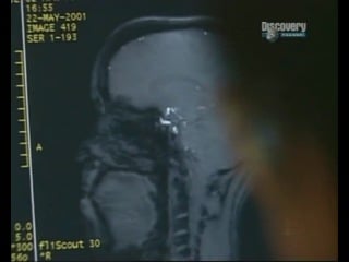 Секс с инвалидами