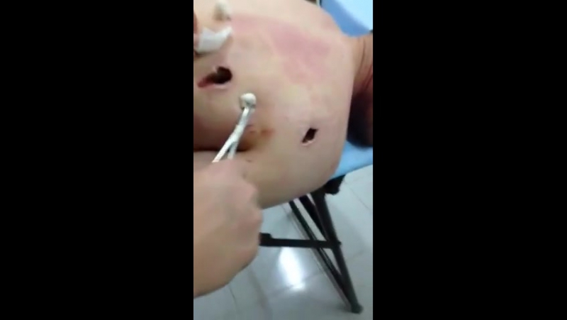 Раненный чеченец в аэропорту донецка, украина donbas militiaman