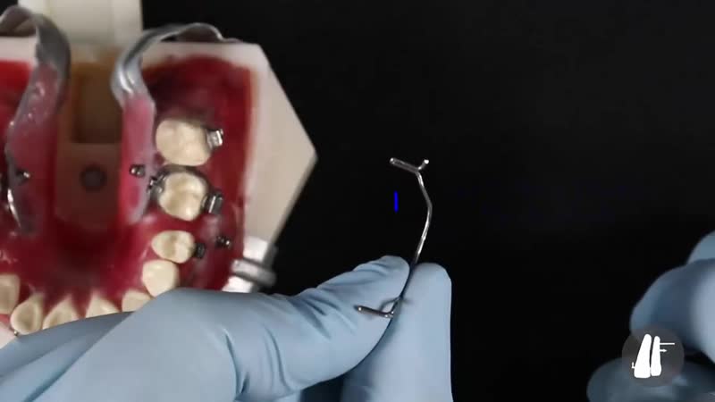 Tip back with tpa essential biomechanics ортодонтия