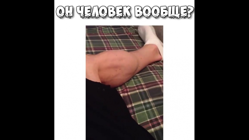 Удивительный контроль мышц ❕ похоже на судорогу, но автор видео утверждает, что делает это мышцами произвольно и когда захочет
