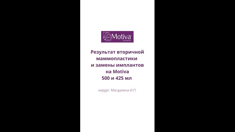 Результат вторичной маммопластики