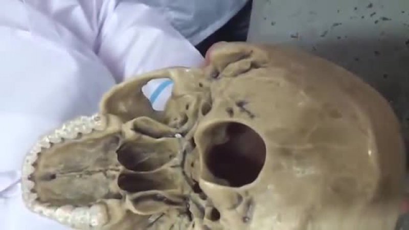 Basis porn video – Наружное основание черепа basis cranii externa