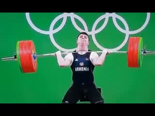 Вывих локтя в обратную сторону