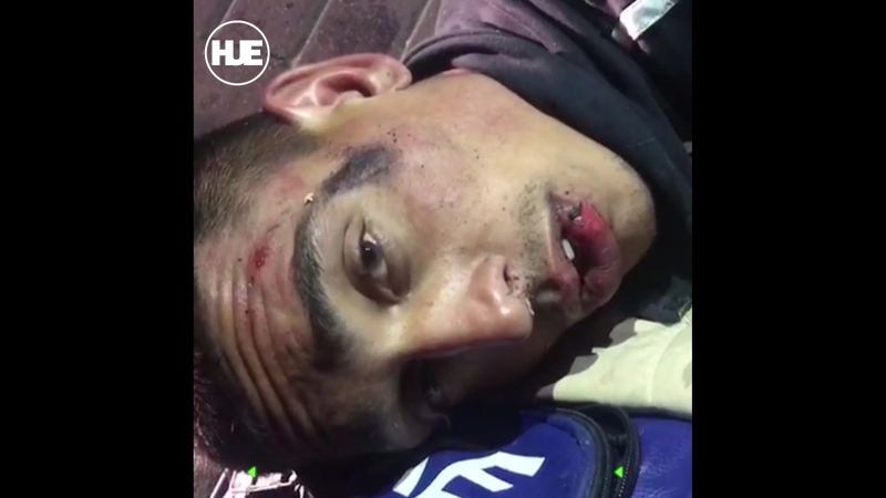 В парке города дзержинский парень напал на полицейских с ножом