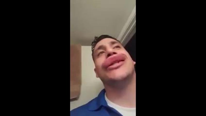 Природная альтернатива инъекциям ботокса