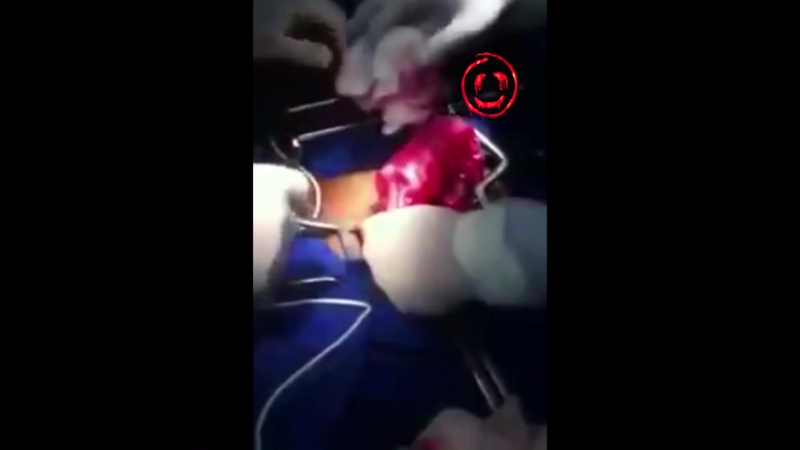 Достали из жопы дезодорант