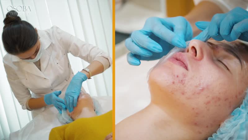 Osoba beauty club о пилингах