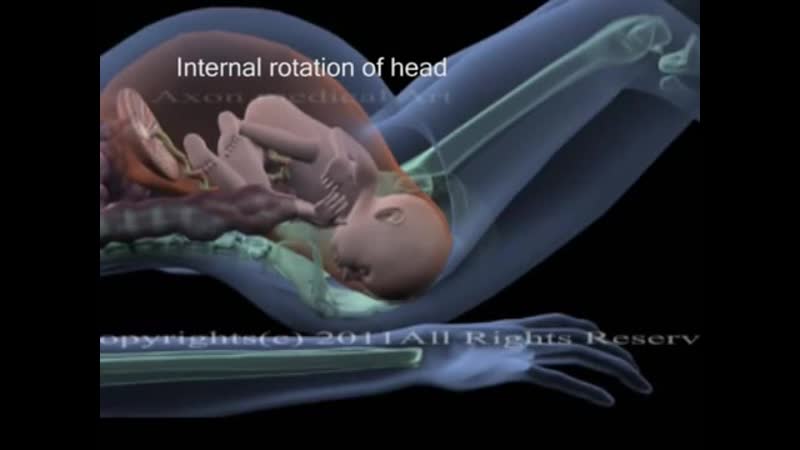 Childbirth animation movements of fetus during birth