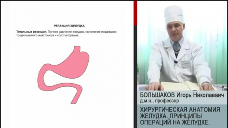 Хирургическая анатомия желудка принципы операций на желудке