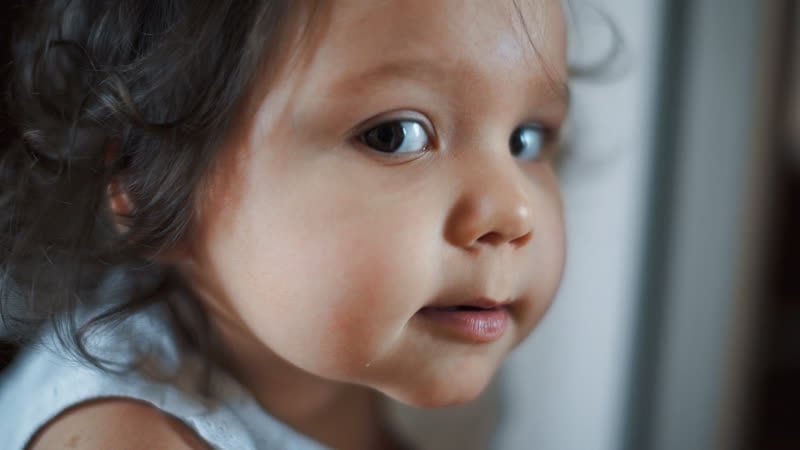 Болезнь забирает леночку! помогите спасти малышку