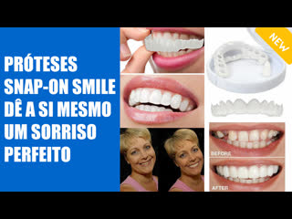 🚫 folheados e lumineiros qual é a diferença de preço 🔥 snap on smile veneers 🔔