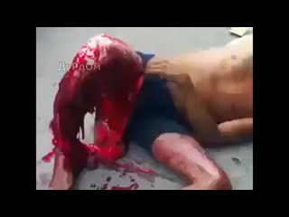 Сбросил кожу с ноги mp4