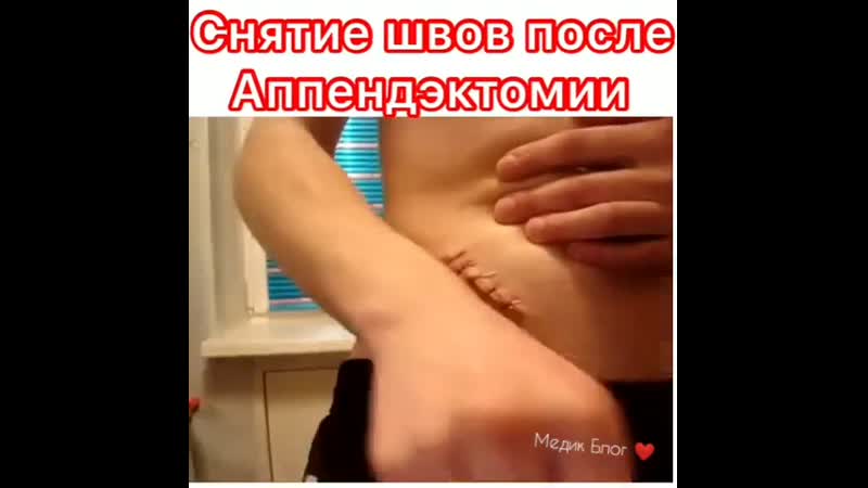 Как вам такое? снятие швов дома 🤷‍♀️