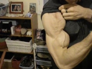 Vascular arm