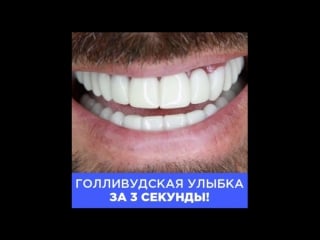 Perfect smile veneers дарят привлекательную белоснежную улыбку!