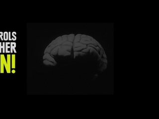 Real life cyborgs you didn't know existed