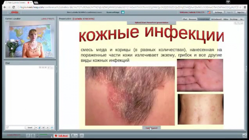 Лечение корицей и медом