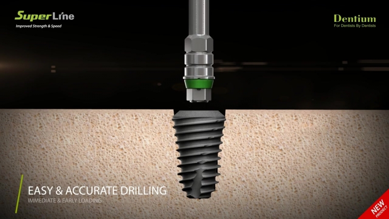 Передовые технологии протезирования зубов в комсомольске