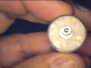 Dr gerard cuomo dental implant work dentists implant jig boca raton, florida