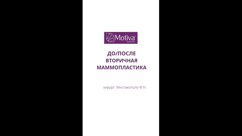 Вторичная маммопластика