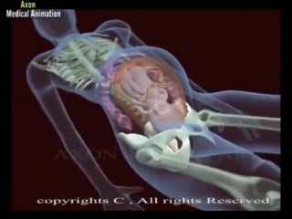 Porn birth ! normal delivery vs caesarean delivery, 8 reasons animation