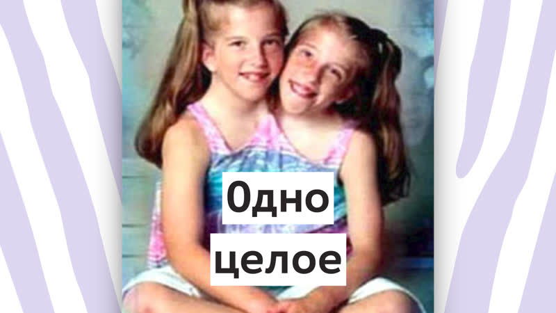 Сиамские близнецы эбигейл и бриттани хенсел