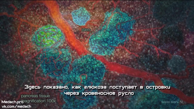 Воспаление и сахарный диабет 2 типа