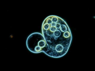 Caught on tape! amazing video! cell division in a protozoan @ 400x (1)