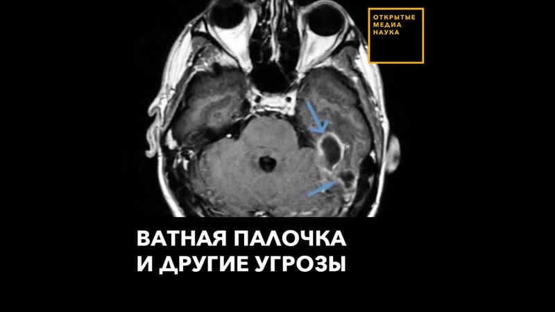 Ватная палочка и другие угрозы
