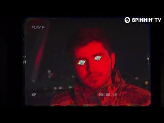 Block & crown x axa ready or not