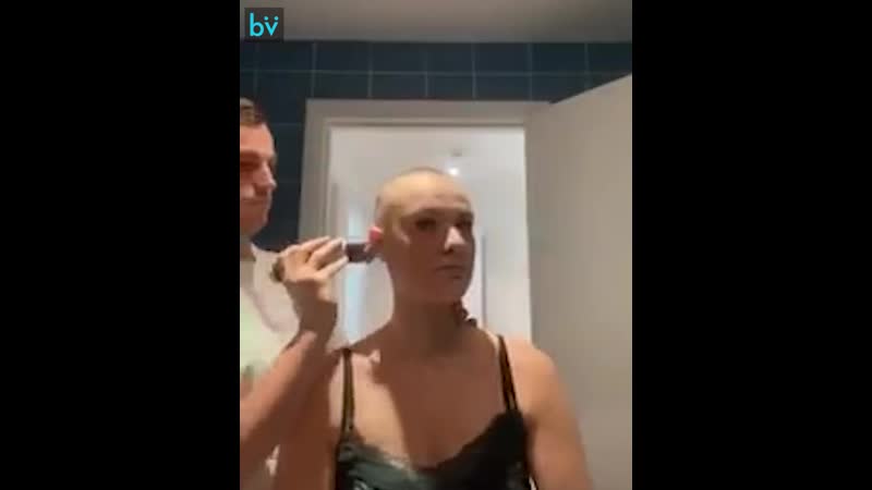 Девушка этого парня больна алопецией и он её поддержал