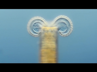 2012 nikon small world in motion honorable mention