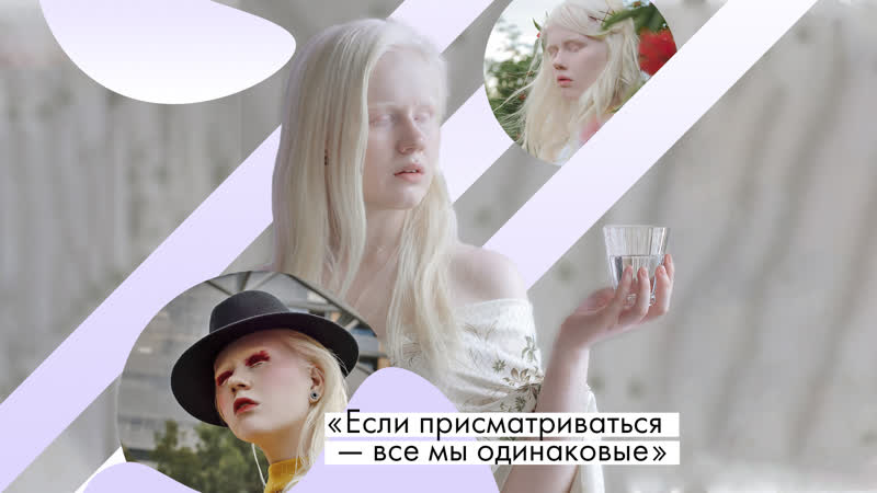 Девушка альбинос о молодые, принятии себя и красоте