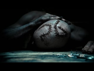 Ahs 6 / teaser post op