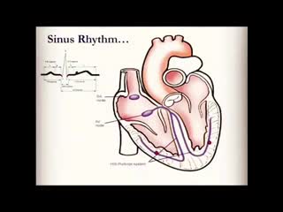 Наглядная анимация по экг