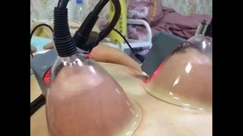 Вакуумный массажёр для увеличения груди+rf!