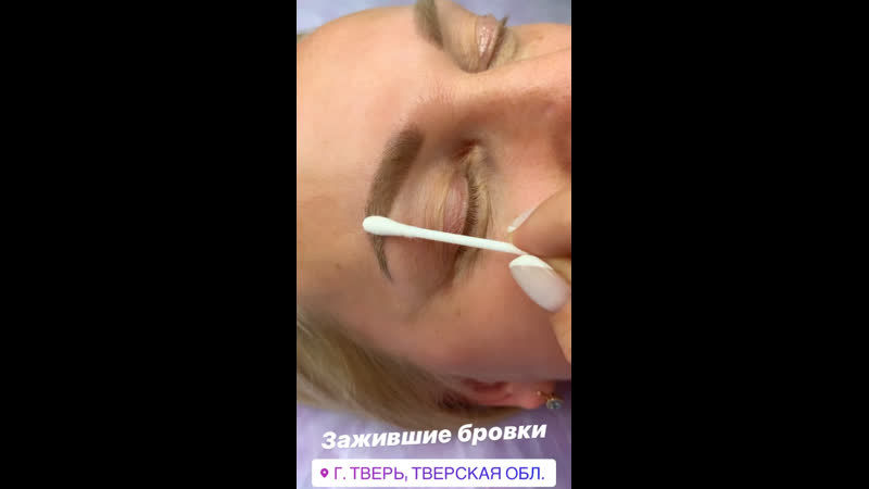 Зажившие брои