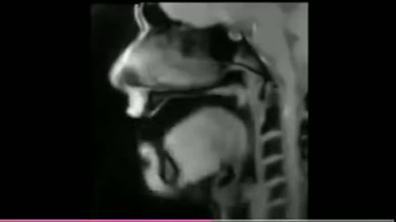 Томография речи