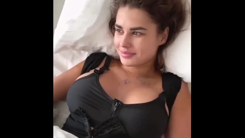 Ирина пинчук увеличила грудь а араик сделал ринопластику в турции🔥🔥🔥 #дом2 #dom2