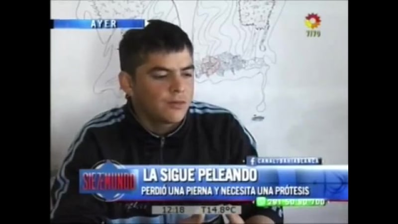 Lb24 perdió la pierna hace 2 años y necesita ayuda canal 7