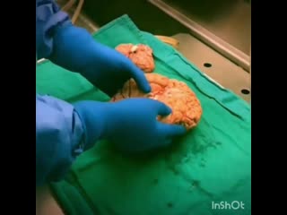 Препарат человеческого мозга