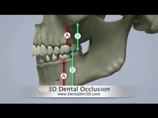 Dentalart3d 3d dental occlusion гнатология