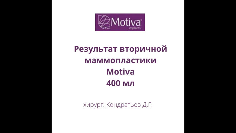 Результат вторичной маммопластики