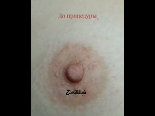 Перманентный макияж ареолы