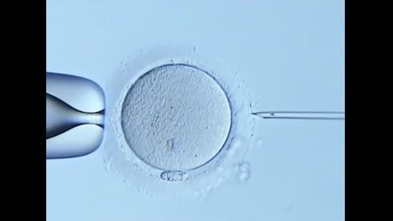 Экстракорпоральное оплодотворение